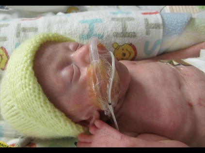 Richards Bay's 'little braveheart' has picked up 360 grams since she was born four months premature, weighing only 700 grams