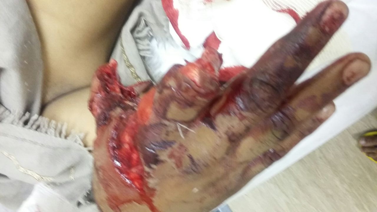 hand